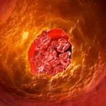 Cardiometabolic