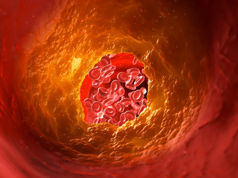Cardiometabolic