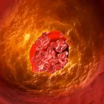 Cardiometabolism
