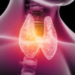 thyroid