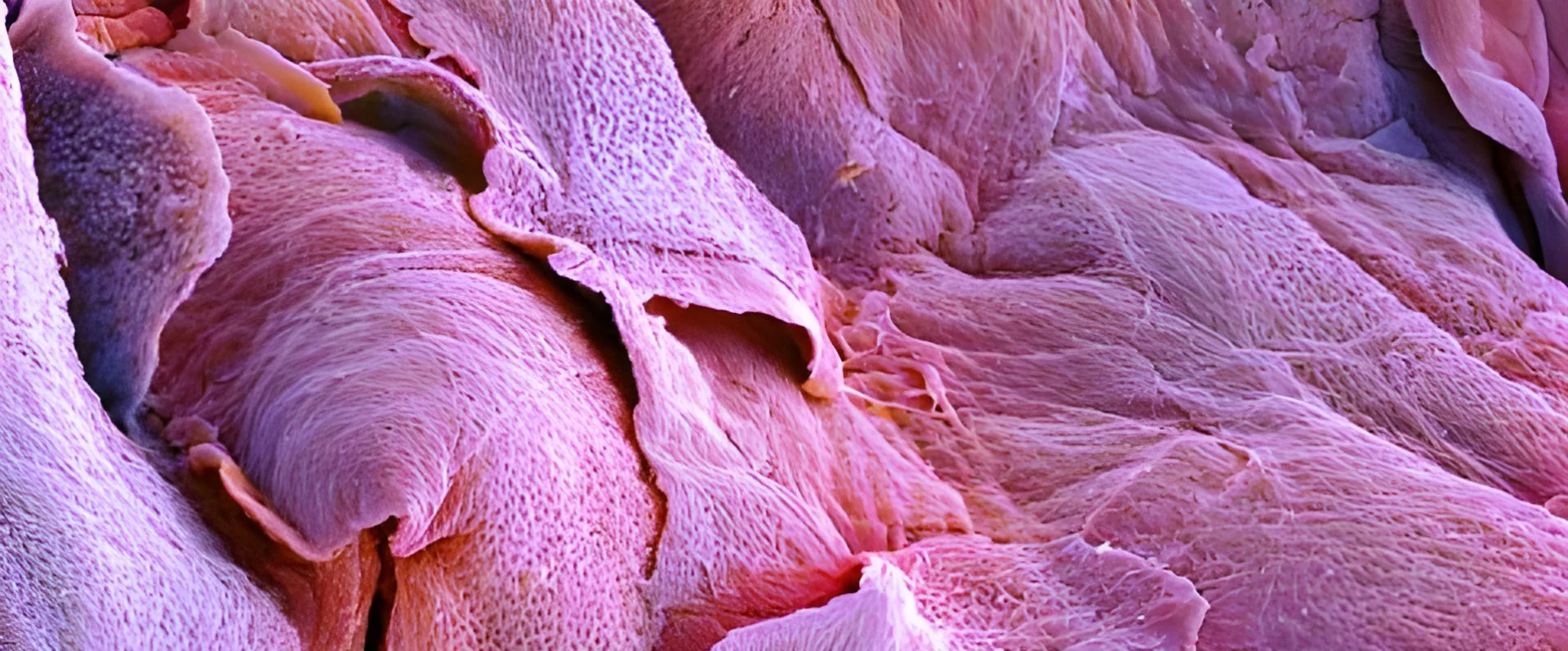Dermatology